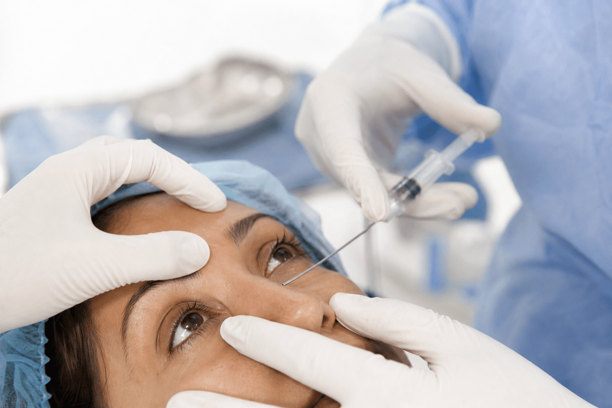 Nasolacrimal Duct Obstruction (Probing & Syringing)